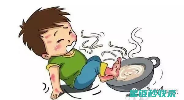 烫伤初期护理指南：发现轻微烫伤时的正确处理步骤